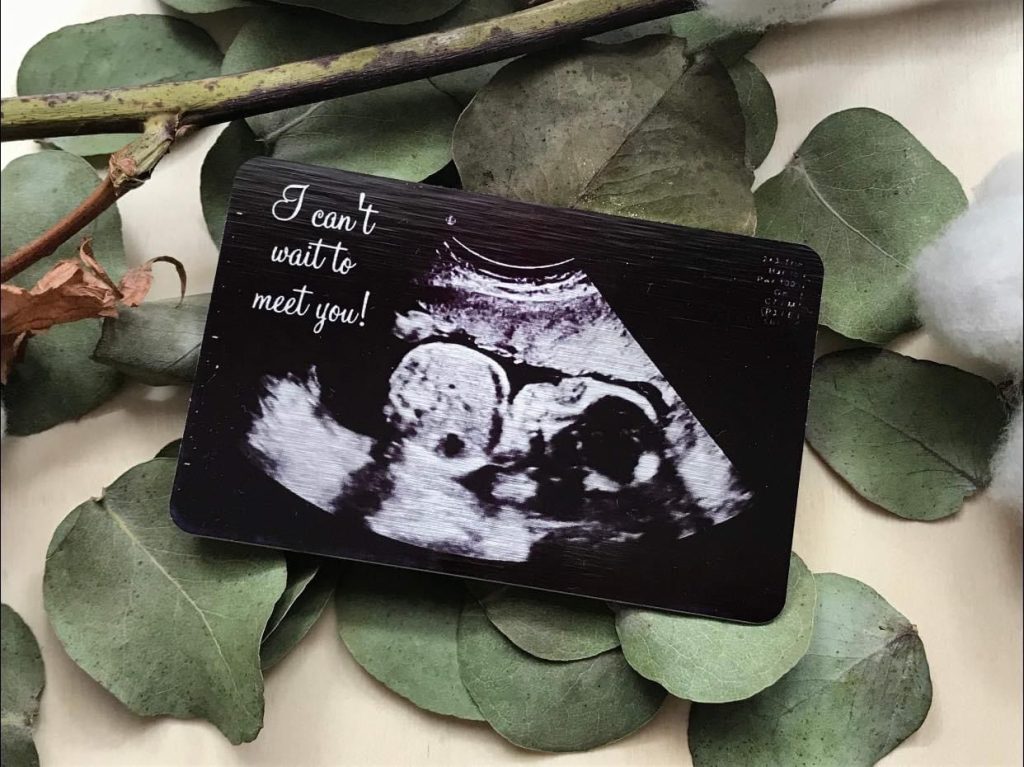 cadou personalizat cu ecografia bebelusului